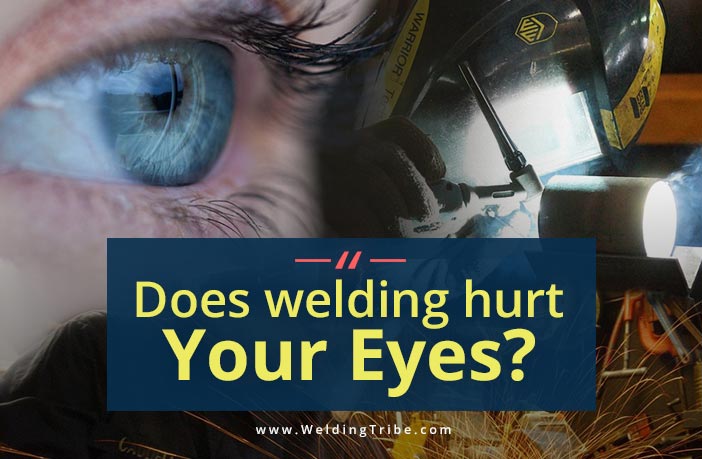 does welding hurt your eyes